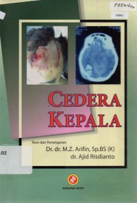 Image of Cedera Kepala